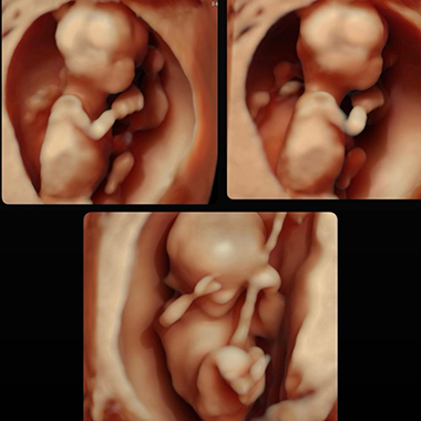 Ginecología, Obstetricia y Materno Fetal